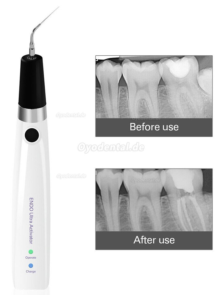 Sonic Ultraschall endoactivator handstück für Irrigator endodontie Schnurlos+6pcs Titanspitzen